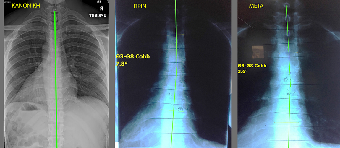 x-ray-img